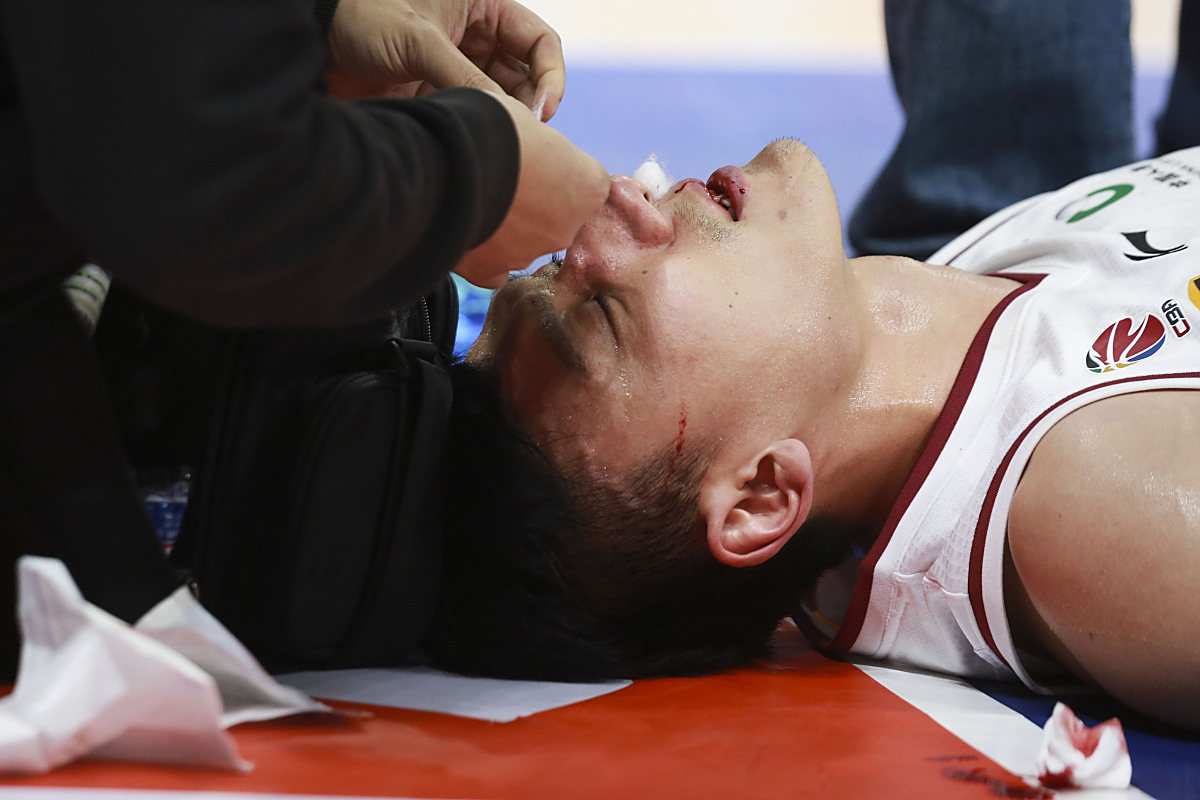 开云-克罗地亚队长受伤：世界杯防线受挫的简单介绍